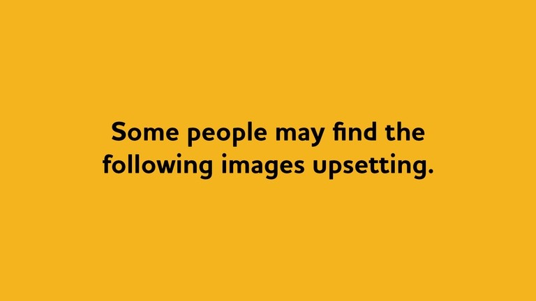 Images content warning.