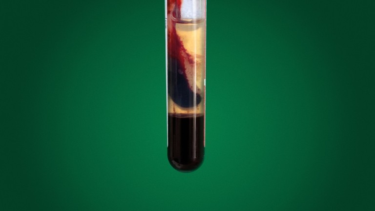 Normal blood sample