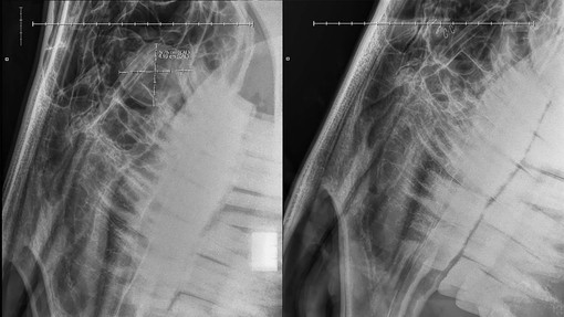 X-ray showing Dinis teeth and the mass in her nasal passage