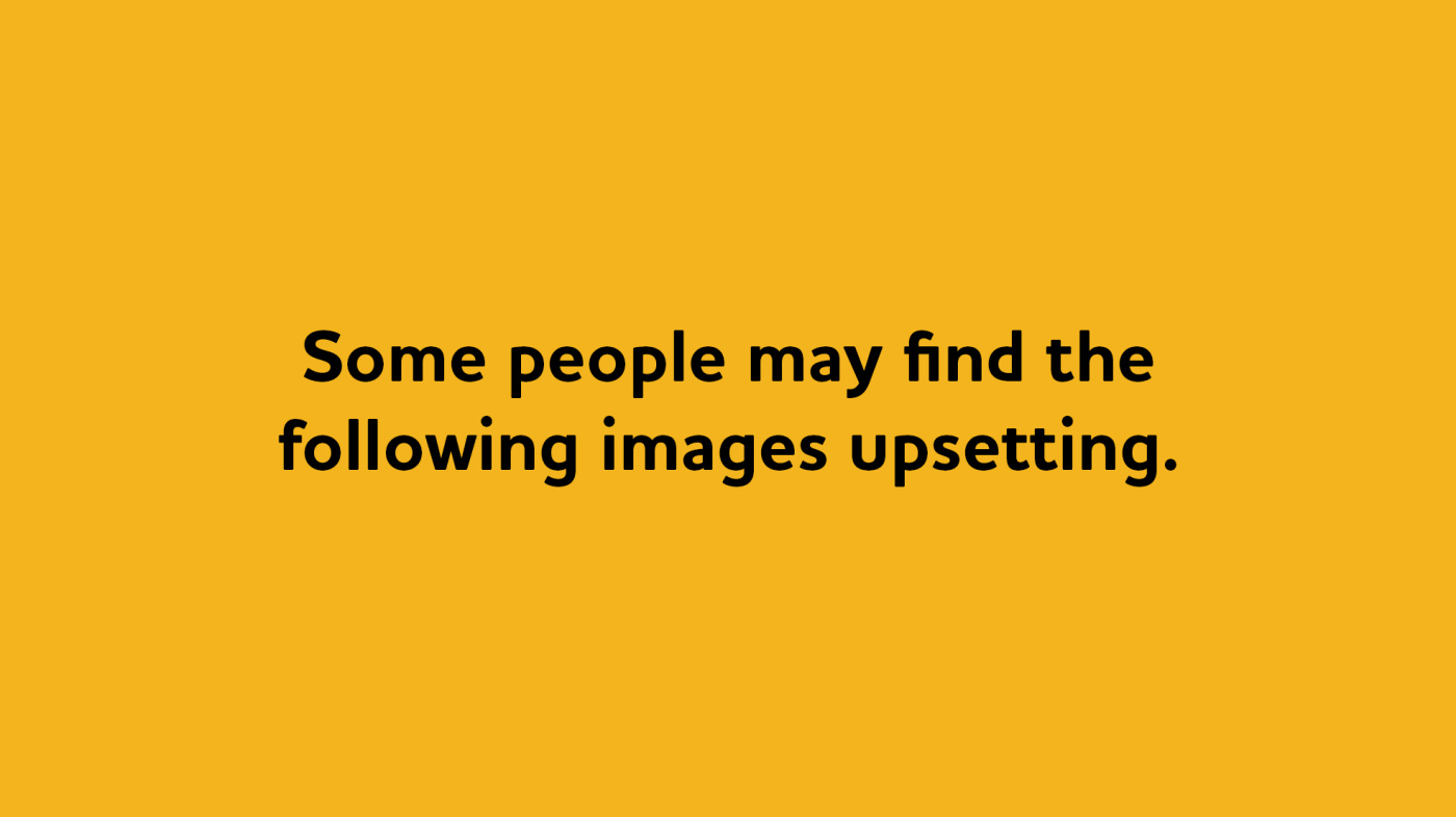 Images content warning